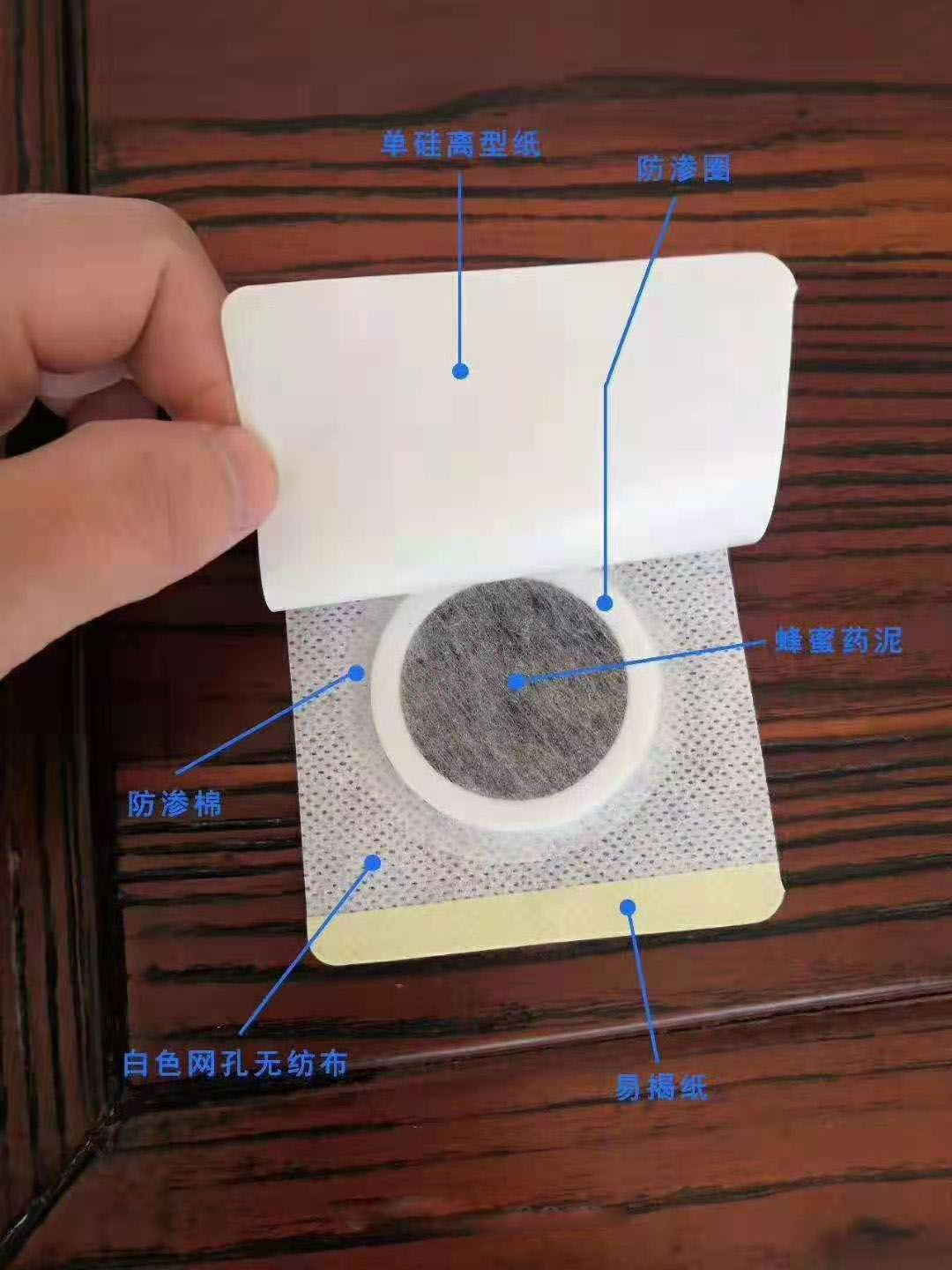 穴位壓力刺激貼。